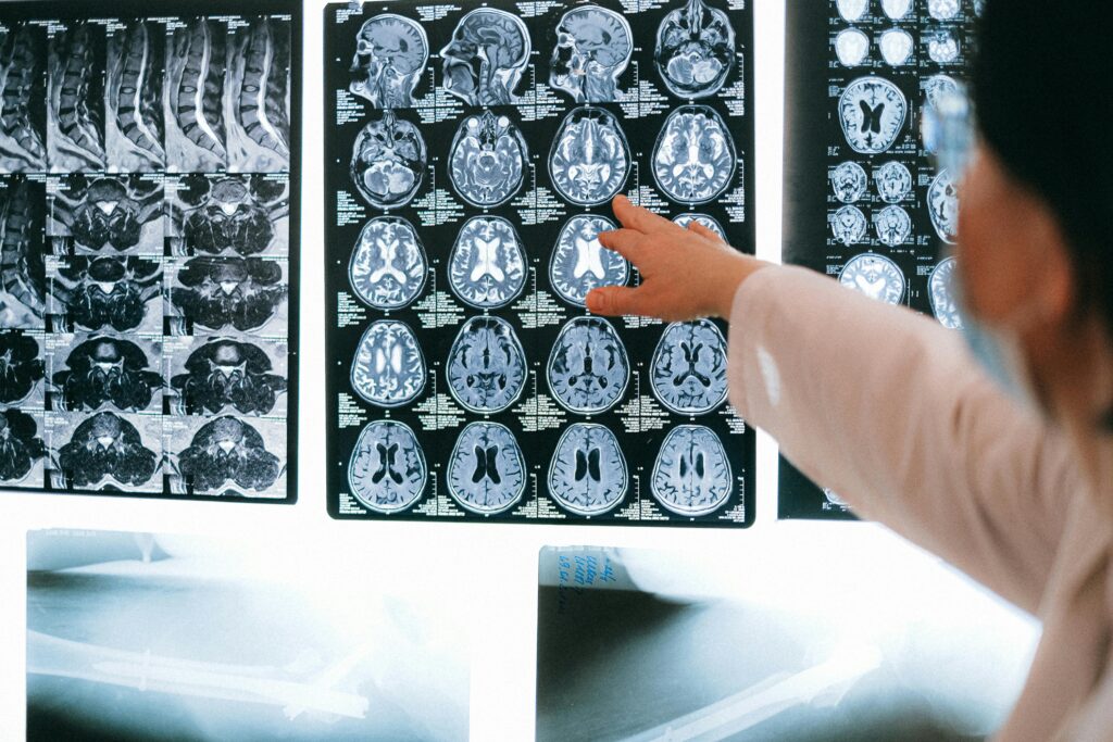 Medical Imaging With Ai Analyzing A Scan For Anomalies